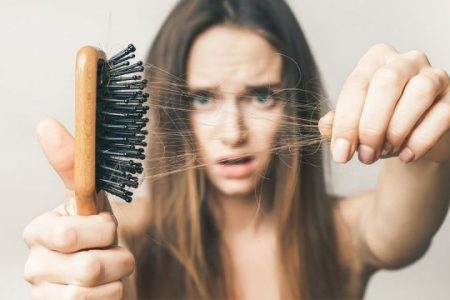 hair-loss